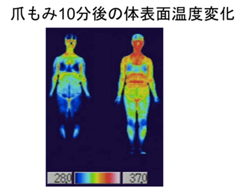 爪もみ10分後の体表面温度変化